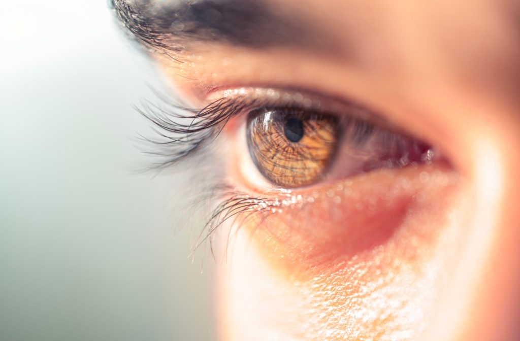 A close-up of a patient's brown eye.