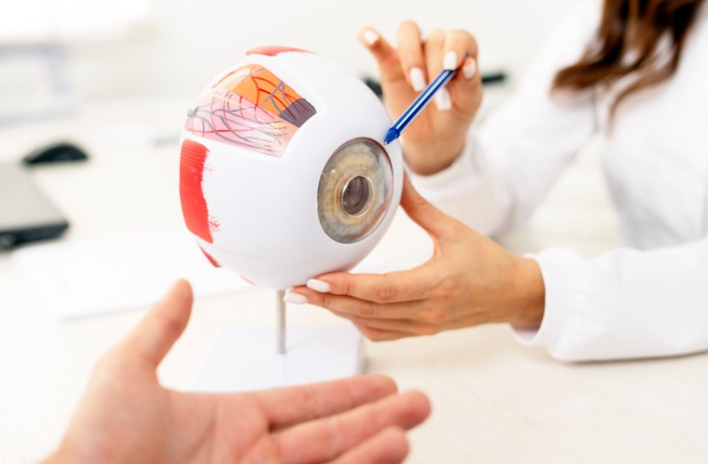 An optometrist explains how eye freckles form using an anatomical model of an eye.