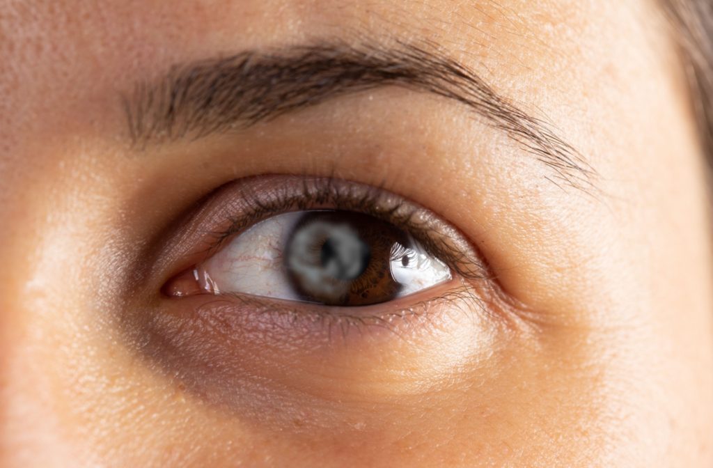 A close-up of a woman's eye with a hazy film covering it.